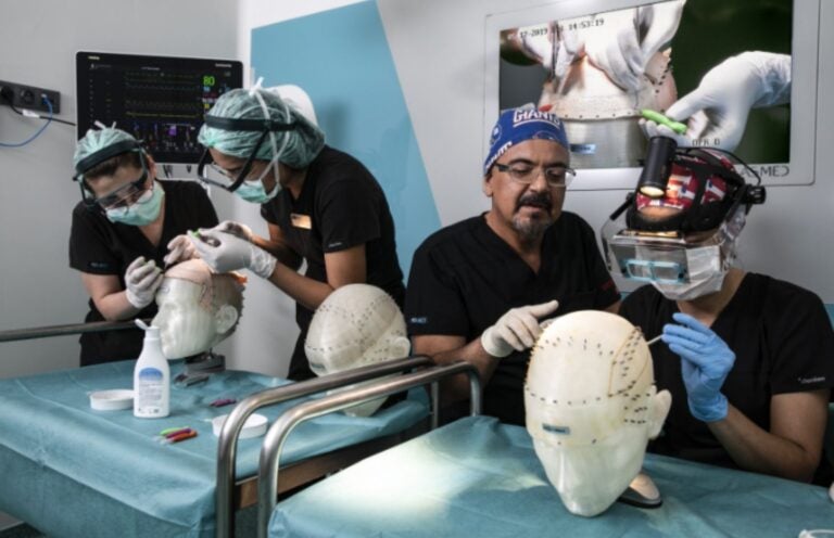 Hair transplant training on KE-HEAD